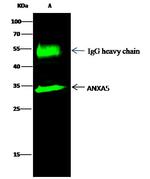 Annexin V Antibody in Immunoprecipitation (IP)