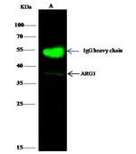 Arginase 1 Antibody in Immunoprecipitation (IP)