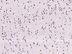 ATF Antibody in Immunohistochemistry (Paraffin) (IHC (P))