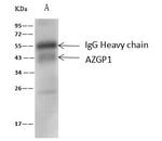 AZGP1 Antibody in Immunoprecipitation (IP)