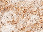 beta-2 Microglobulin/FCRN Antibody in Immunohistochemistry (Paraffin) (IHC (P))