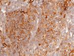 beta-2 Microglobulin/FCRN Antibody in Immunohistochemistry (Paraffin) (IHC (P))