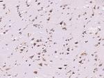 B3GAT3 Antibody in Immunohistochemistry (Paraffin) (IHC (P))