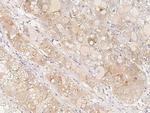 BAD Antibody in Immunohistochemistry (Paraffin) (IHC (P))