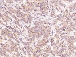 Beclin 1 Antibody in Immunohistochemistry (Paraffin) (IHC (P))