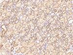 Beclin 1 Antibody in Immunohistochemistry (Paraffin) (IHC (P))