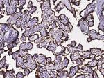 Calreticulin Antibody in Immunohistochemistry (Paraffin) (IHC (P))