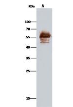 Calreticulin Antibody in Immunoprecipitation (IP)