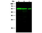 Calreticulin Antibody in Western Blot (WB)