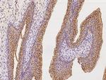 CD47 Antibody in Immunohistochemistry (Paraffin) (IHC (P))