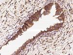 CD47 Antibody in Immunohistochemistry (Paraffin) (IHC (P))