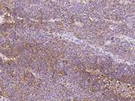 CD47 Antibody in Immunohistochemistry (Paraffin) (IHC (P))