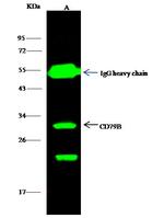 CD79b Antibody in Immunoprecipitation (IP)