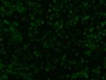 CD99 Antibody in Immunocytochemistry (ICC/IF)