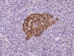 CD99 Antibody in Immunohistochemistry (Paraffin) (IHC (P))