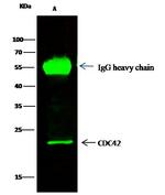 CDC42 Antibody in Immunoprecipitation (IP)