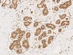 CDK4 Antibody in Immunohistochemistry (Paraffin) (IHC (P))