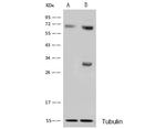 CDK4 Antibody in Western Blot (WB)