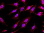 CIDEA Antibody in Immunocytochemistry (ICC/IF)