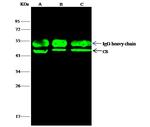 Citrate Synthase Antibody in Immunoprecipitation (IP)