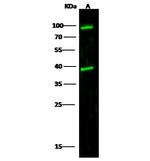 Cathepsin L Antibody in Western Blot (WB)