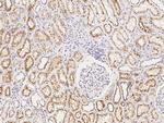 CUX1 Antibody in Immunohistochemistry (Paraffin) (IHC (P))