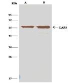 LAP3 Antibody in Immunoprecipitation (IP)