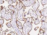 Aromatase Antibody in Immunohistochemistry (Paraffin) (IHC (P))