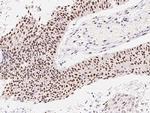 ZIPK Antibody in Immunohistochemistry (Paraffin) (IHC (P))