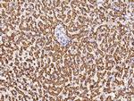 DECR1 Antibody in Immunohistochemistry (Paraffin) (IHC (P))