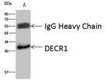 DECR1 Antibody in Immunoprecipitation (IP)