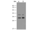 DECR1 Antibody in Western Blot (WB)