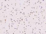 ECSIT Antibody in Immunohistochemistry (Paraffin) (IHC (P))