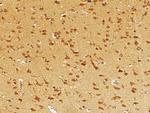 EphB3 Antibody in Immunohistochemistry (Paraffin) (IHC (P))