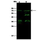 Epsin 3 Antibody in Western Blot (WB)