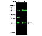 ETHE1 Antibody in Western Blot (WB)