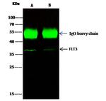 FLT3 Antibody in Immunoprecipitation (IP)