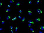 GALNT2 Antibody in Immunocytochemistry (ICC/IF)