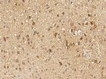 GALNT2 Antibody in Immunohistochemistry (Paraffin) (IHC (P))