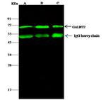 GALNT2 Antibody in Immunoprecipitation (IP)