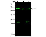 GALNT2 Antibody in Western Blot (WB)