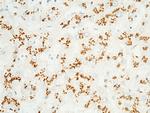 GOLPH2 Antibody in Immunohistochemistry (Paraffin) (IHC (P))