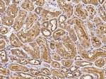 GOT1 Antibody in Immunohistochemistry (Paraffin) (IHC (P))