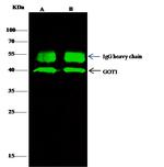 GOT1 Antibody in Immunoprecipitation (IP)