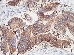 A33 Antibody in Immunohistochemistry (Paraffin) (IHC (P))