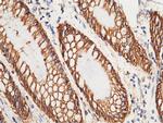 A33 Antibody in Immunohistochemistry (Paraffin) (IHC (P))