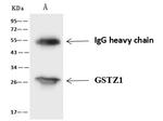 GSTZ1 Antibody in Immunoprecipitation (IP)