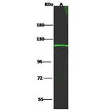 HK1 Antibody in Western Blot (WB)