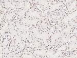 HMGB1 Antibody in Immunohistochemistry (Paraffin) (IHC (P))