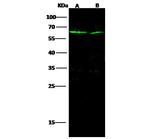 IL-1RAcP Antibody in Western Blot (WB)